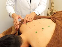 リケア 西新宿鍼灸院(reCare)の雰囲気(鍼とお灸をお好みに合わせて、どちらも使用します。)