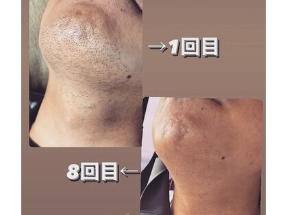 ダンディラボ(Dandy Lab)の写真