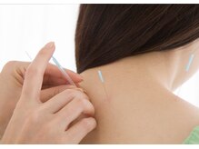 1番人気♪鍼灸+マッサージで体をしっかりメンテナンスできます