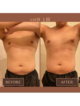 ファミーユ 名古屋店/【メンズインディバ】ダイエット