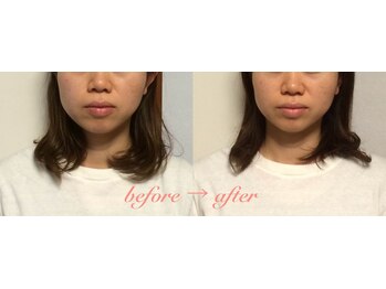 整体いったんとこ/小顔矯正