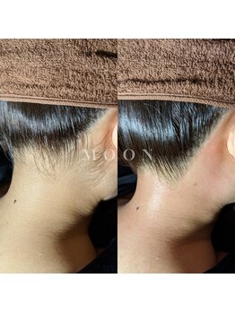 ムーン 横浜(MOON)/【うなじ】