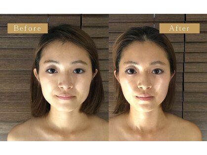 グレースフィオーレ 西宮北口店(gracefiore)の写真