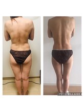 ヨサパーク ブリス(YOSA PARK blis)/ちゃんとやれば痩せます