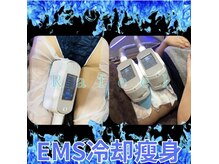 ラフィール/最強痩身：ぽっこりお腹：冷却