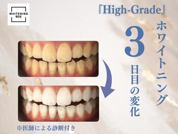 ホワイトニングボックス 豊川店/施術3回目終了後