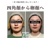 キュープ 高崎店(Qpu)/小顔頭蓋骨矯正＋オイルケア