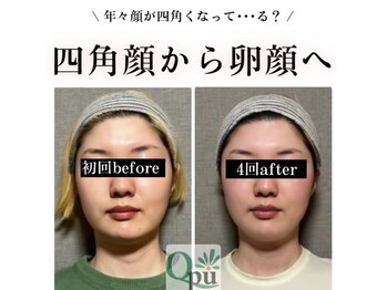 キュープ 高崎店(Qpu)/小顔頭蓋骨矯正＋オイルケア