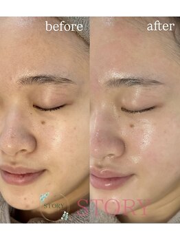 ストーリー(STORY)/眉毛と艶肌ワックス専門店