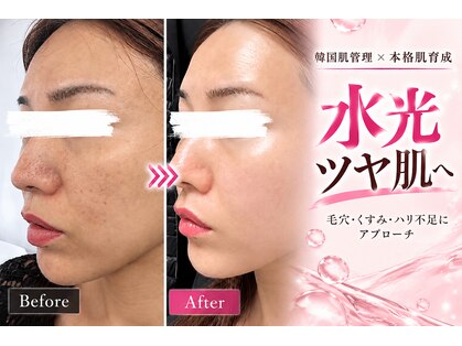 ソエルテ(soerute)の写真