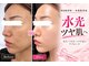 ソエルテ(soerute)の写真