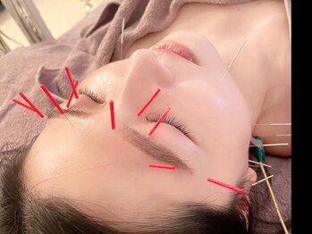 マリ美容鍼灸(mari美容鍼灸)