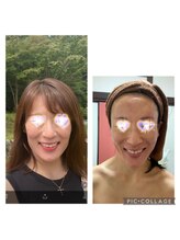 ケニー(Kenny)/造顔・小顔