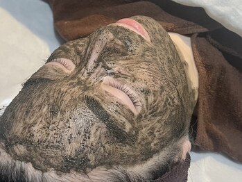 ヨハク 市川店(yohaku)/ヒト幹細胞ブラックハーブ