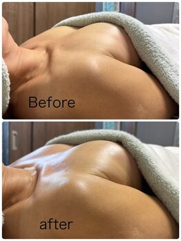 ベッピン(Beppin)/バストケア/下垂ケア/バスト静岡