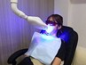【セルフホワイトニング】脱マスク☆白い歯!見た目年齢－5歳！5390→3500
