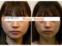 ロージースマイル(Rosy smile)の雰囲気（本格小顔コルギ》輪郭矯正/左右バランス/むくみ解消/根強いコリ）