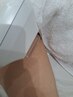 【脱毛】Vｌ０　10000→８０００