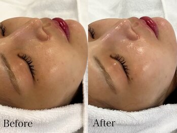 トム(Thom)/ツヤ肌・たまご肌になりたい方☆