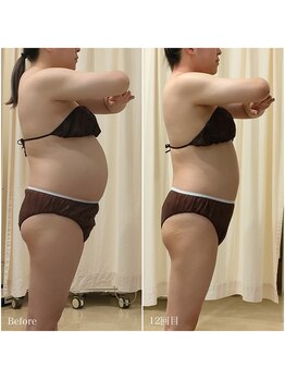 ルノン(Lunon)/《上半身痩せ》ぽんぽこお腹に