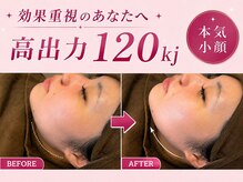 リフト 札幌(Lift)の雰囲気(小顔・脂肪燃焼に特化*マイクロウェーブ痩身【札幌】)