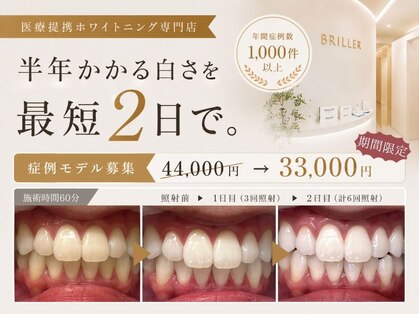 ホワイトニング専門店BRILLER 久屋大通店【7月NEW OPEN（予定）】の写真