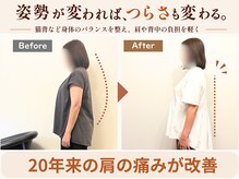 ピースフルポイント(Peaceful Point)の雰囲気（背中にファスナーのある服が自分で着られるようになって嬉しい）