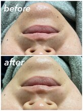 ジョエルワックス 沖縄糸満店(JOELLE WAX)/ツルツルお肌♪