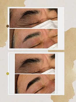 エターナル(Eternal)/男性の太くて長い剛毛眉もOK