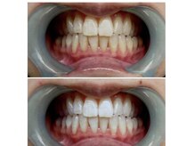 ファミリーセルフサロン 輪(Wa)/マスク外した歯綺麗ですか？