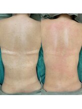 スリジエ ボーテ(cerisierBEAUTE)/極度な日焼け肌,乾燥肌にも◎