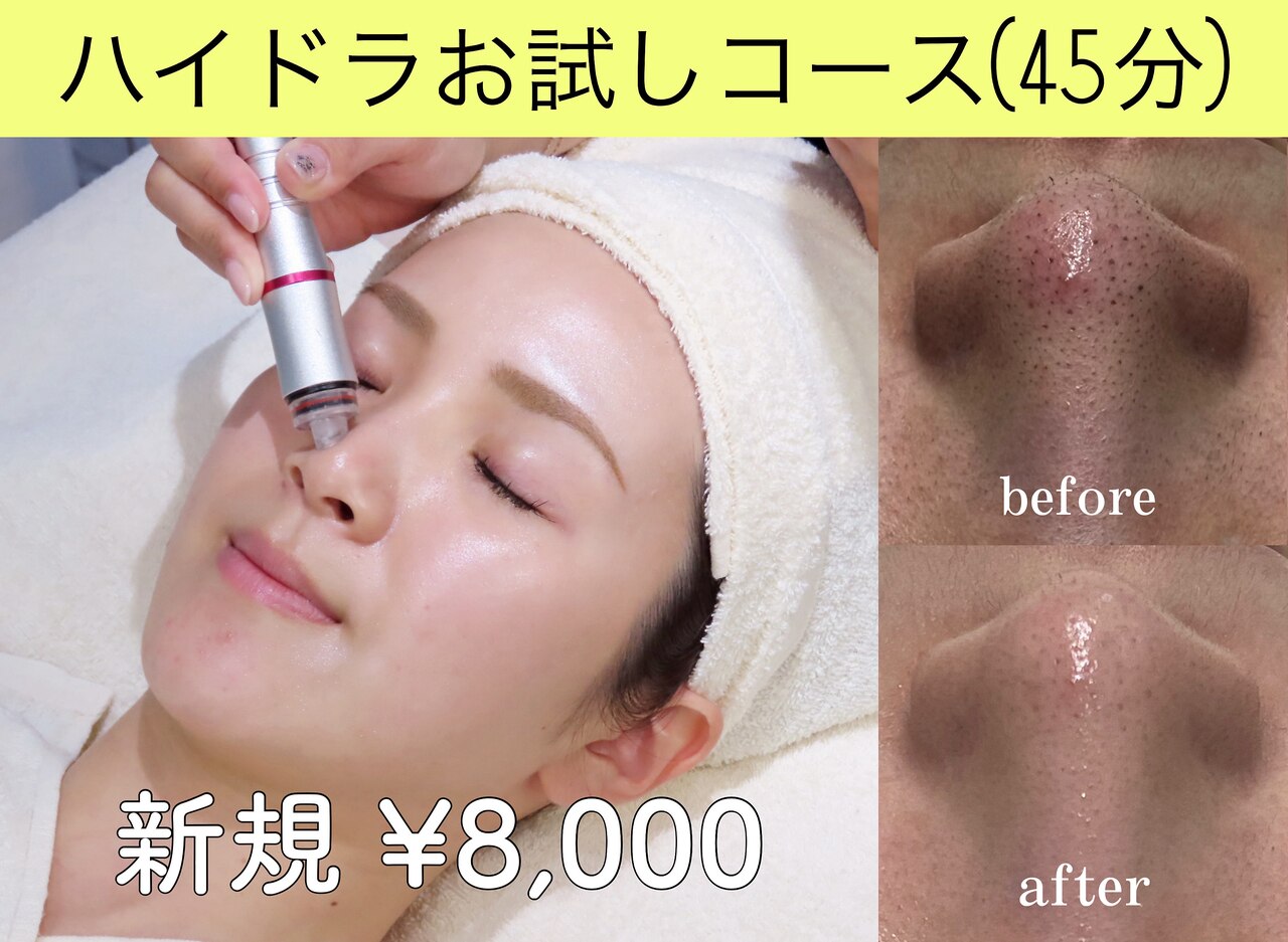 【ハイドラお試しコース】皮脂トラブル！脱いちご鼻！ 35分