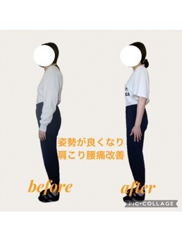 フォーシー(4C)/Before/After