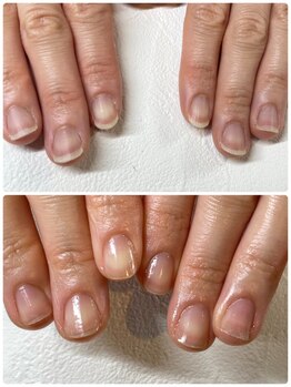 ラヴィネイル(La Vie Nail)/ 美爪育成ネイルケアコース