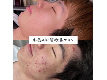 ベリッシマ(Bellissima)の雰囲気（根本の肌質改善で繰り返さないお肌に。終わりのあるサロンです☆）