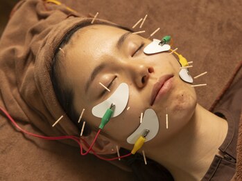 ジネコラボ 横浜(Gyneco-labo)/人気の美容鍼【そだてる美顔鍼】