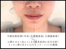 本物志向の小顔＆肌管理｜肌が変われば人生も変わる♪