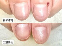 ココモ(cocomo)/(深爪/長さだし/フィルイン)