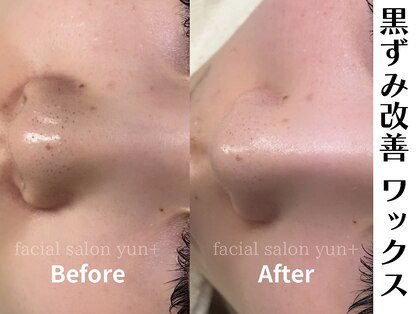 ユンプラス(yun+)の写真