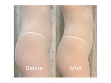 ココフィット(COCOFIT)の雰囲気(1回の施術でマイナス3kg痩せ見え♪)