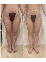 ありひ/セルゼロの効果（下半身）