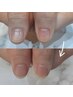 メンズ★深爪矯正コース終了された方限定★爪育・キープコース19000円