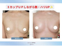 エトワールの雰囲気（幼児体型と言われた平面ボディが立体的なメリハリボディへ♪）