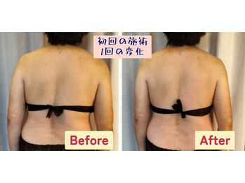スアビス(SUAVIS)の写真/繰り返す体の歪みに！沖縄希少エレクトロ筋膜リリース×看護師経験で深層からほぐして全身バランスを調整◎