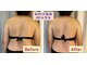 スアビス(SUAVIS)の写真/繰り返す体の歪みに！沖縄希少エレクトロ筋膜リリース×看護師経験で深層からほぐして全身バランスを調整◎