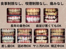 ホワイトニングショップ 長崎時津店の雰囲気（お客様に寄り添い、一人一人合わせたカウンセリングします◎）