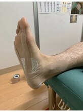 高田馬場名倉堂鍼灸接骨院/テーピングです！