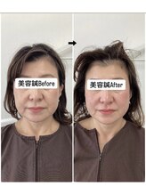 ハリサロンドオフ 堺東店(hari salon de off)/お客様のbefore→after