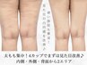 人気No.1【モニター価格】太もも集中！脂肪冷却＋キャビ　4カップ　¥22000