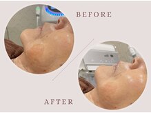 ククルヘルスビューティー(CUCURU health×beauty)/お得にお肌改善